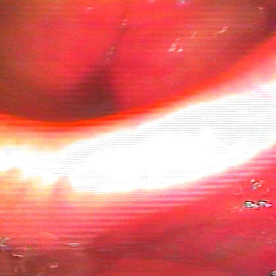 EP ROSABEGE - Rerererê!3 master 2021